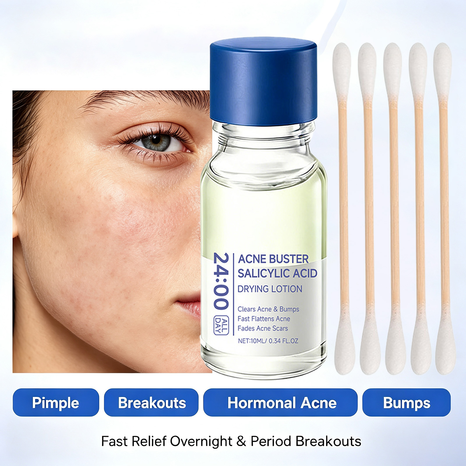 Salicylic Acid Acne Treatment  - Tranexamic Acid Serum 评论和价格